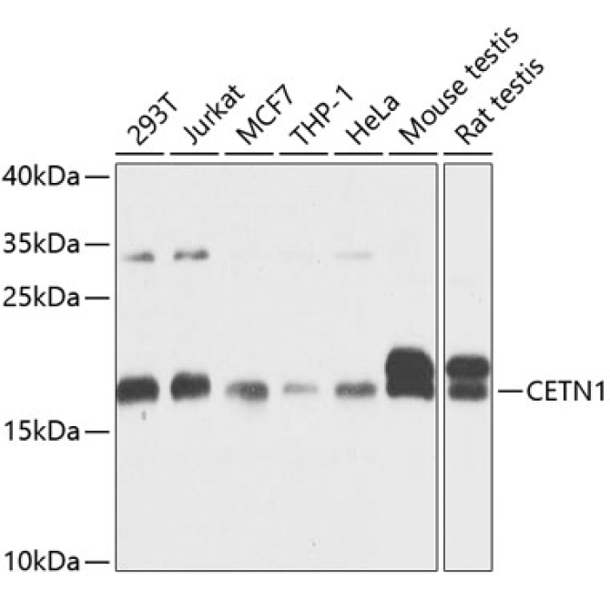 CETN1 Rabbit Polyclonal Antibody