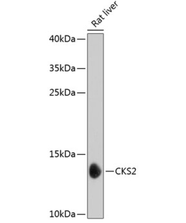 CKS2 Rabbit Polyclonal Antibody