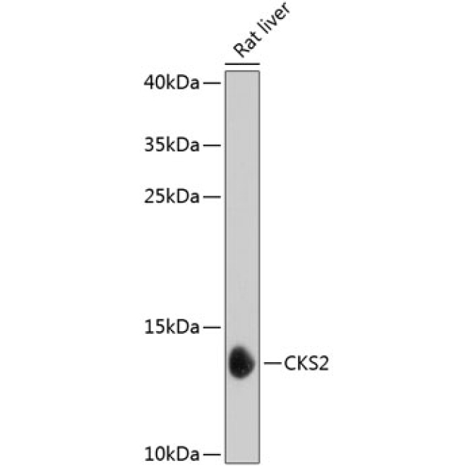 CKS2 Rabbit Polyclonal Antibody
