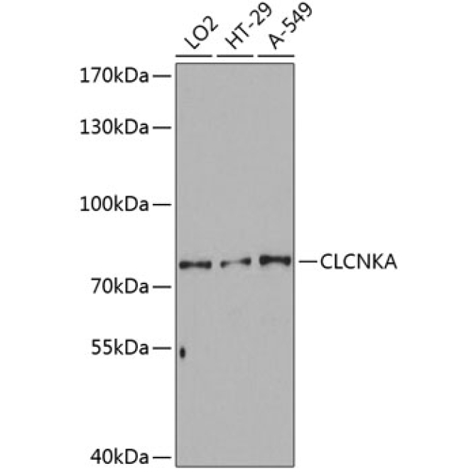 CLCNKA Rabbit Polyclonal Antibody