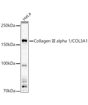 Collagen III alpha 1/COL3A1 Rabbit Polyclonal Antibody