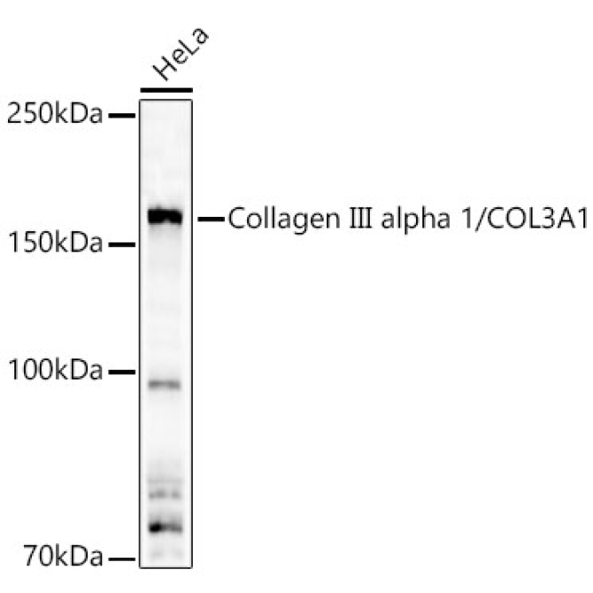 Collagen III alpha 1/COL3A1 Rabbit Polyclonal Antibody