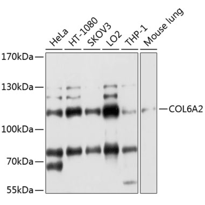 COL6A2 Rabbit Polyclonal Antibody