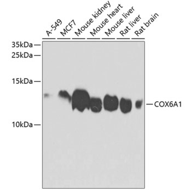 COX6A1 Rabbit Polyclonal Antibody