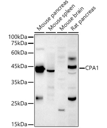 CPA1 Rabbit Polyclonal Antibody