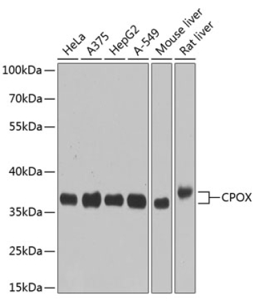 CPOX Rabbit Polyclonal Antibody