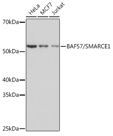 BAF57/SMARCE1 Rabbit Monoclonal Antibody