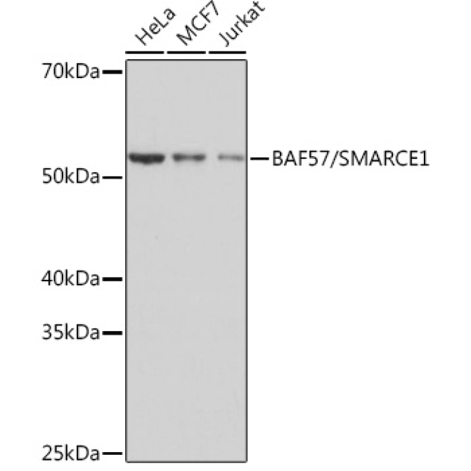 BAF57/SMARCE1 Rabbit Monoclonal Antibody