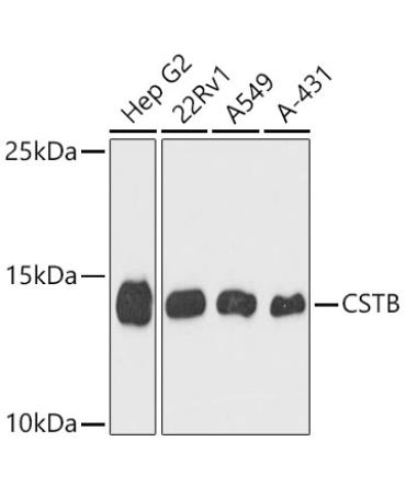 CSTB Rabbit Polyclonal Antibody