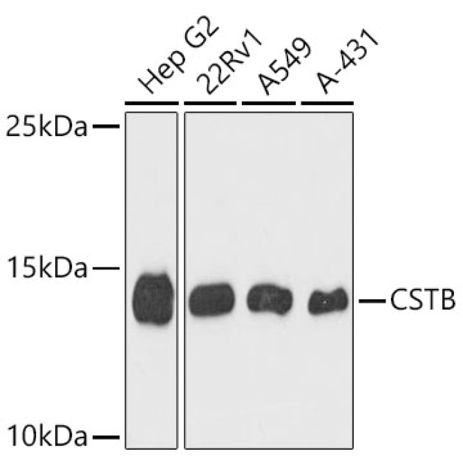 CSTB Rabbit Polyclonal Antibody