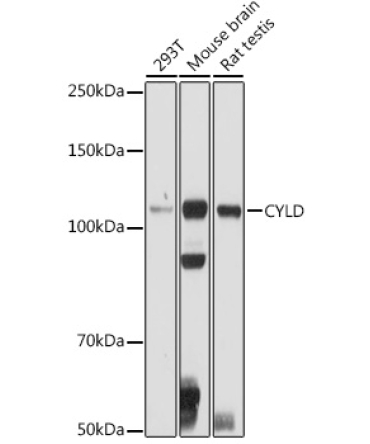 CYLD Rabbit Polyclonal Antibody