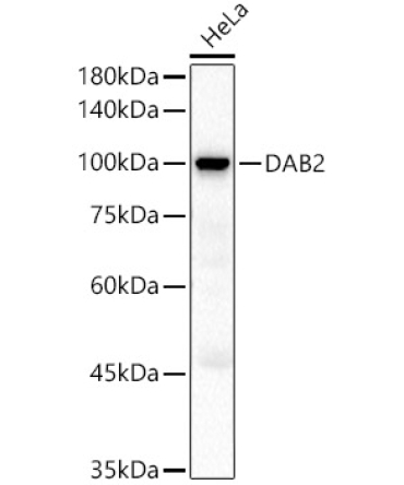 DAB2 Rabbit Polyclonal Antibody