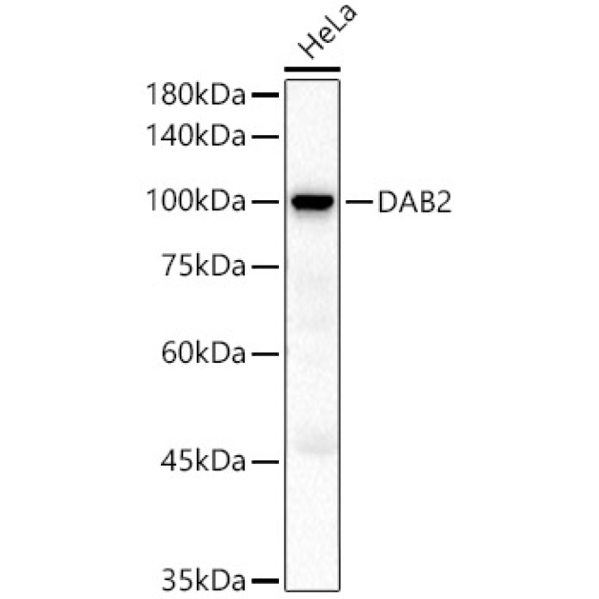 DAB2 Rabbit Polyclonal Antibody