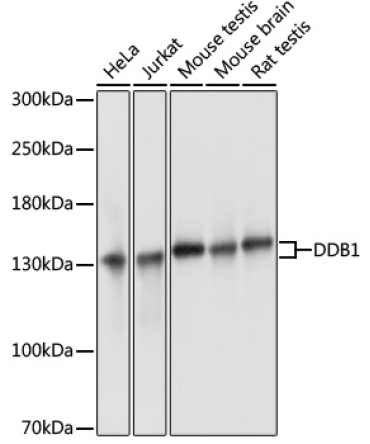 DDB1 Rabbit Polyclonal Antibody
