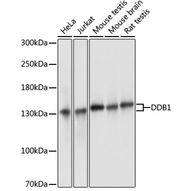 DDB1 Rabbit Polyclonal Antibody