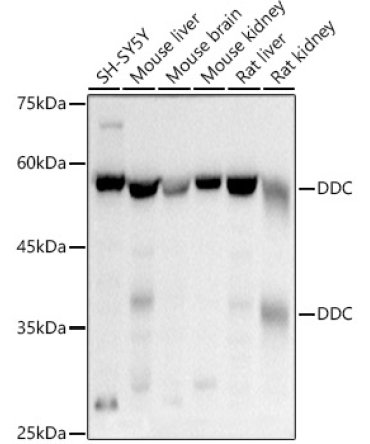 DDC Rabbit Polyclonal Antibody