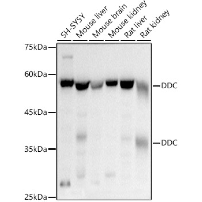 DDC Rabbit Polyclonal Antibody
