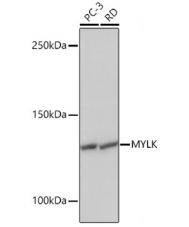 MYLK Rabbit Monoclonal Antibody
