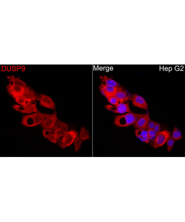 DUSP9 Rabbit Polyclonal Antibody