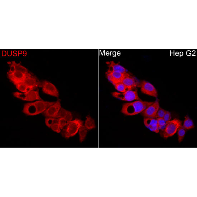 DUSP9 Rabbit Polyclonal Antibody