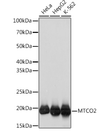 MTCO2 Rabbit Monoclonal Antibody