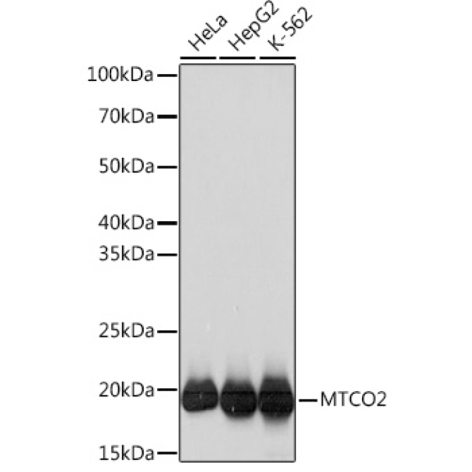 MTCO2 Rabbit Monoclonal Antibody