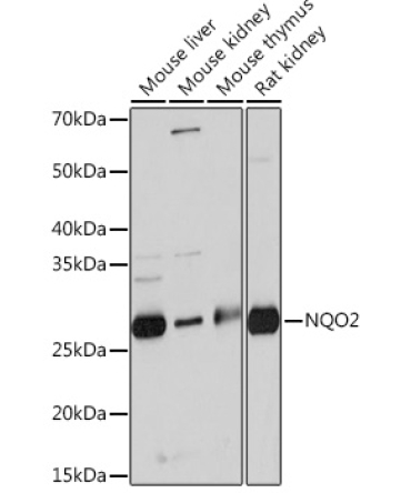 NQO2 Rabbit Monoclonal Antibody