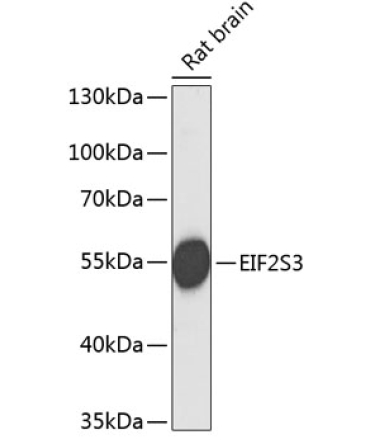 EIF2S3 Rabbit Polyclonal Antibody