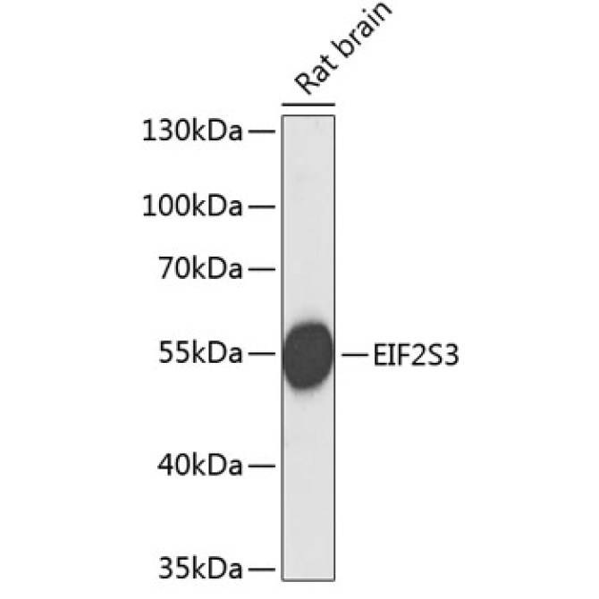 EIF2S3 Rabbit Polyclonal Antibody