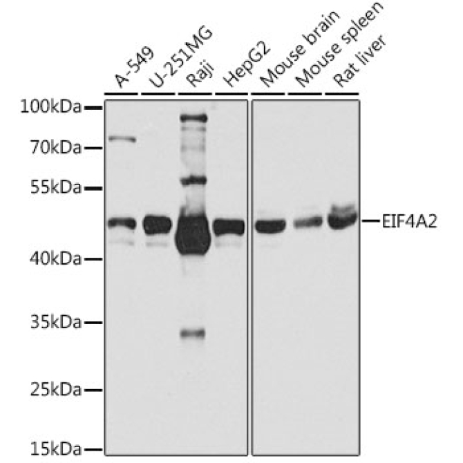 EIF4A2 Rabbit Polyclonal Antibody