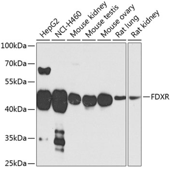 FDXR Rabbit Polyclonal Antibody