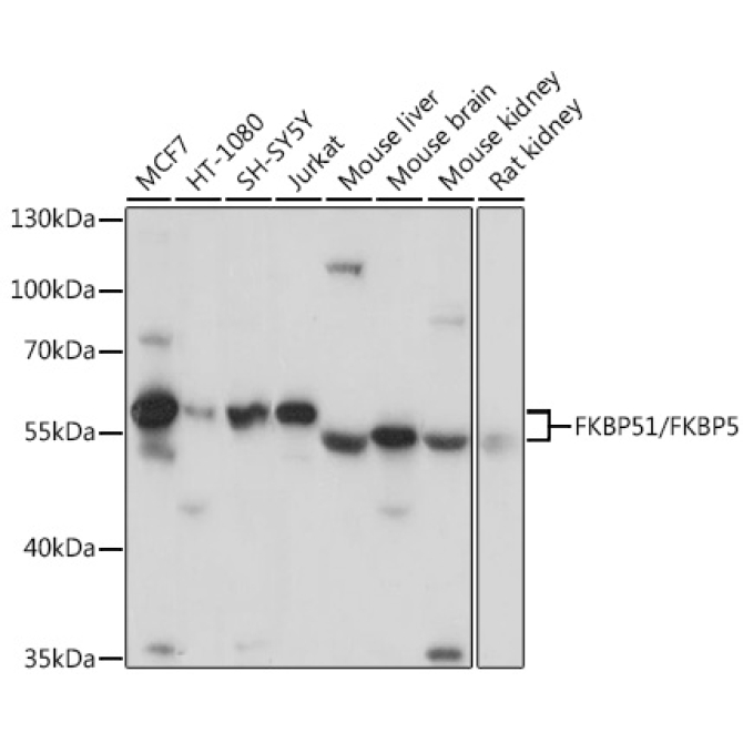 FKBP51/FKBP5 Rabbit Polyclonal Antibody