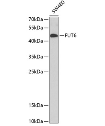 FUT6 Rabbit Polyclonal Antibody
