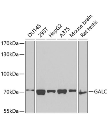 GALC Rabbit Polyclonal Antibody