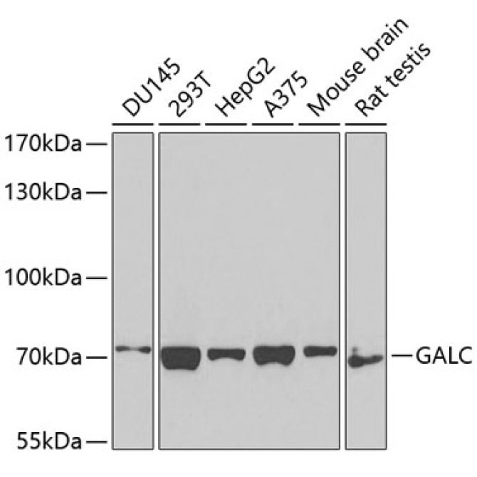 GALC Rabbit Polyclonal Antibody