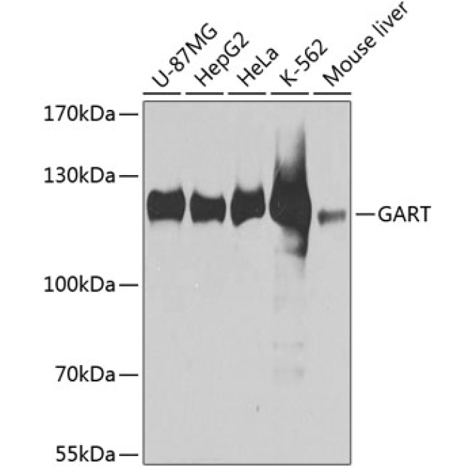 GART Rabbit Polyclonal Antibody