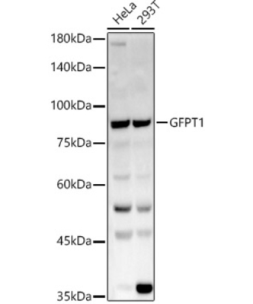 GFPT1 Rabbit Polyclonal Antibody