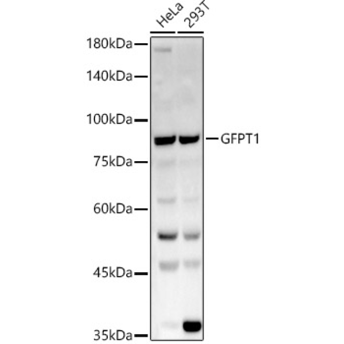 GFPT1 Rabbit Polyclonal Antibody
