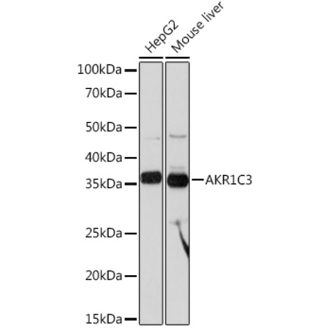 AKR1C3 Rabbit Monoclonal Antibody