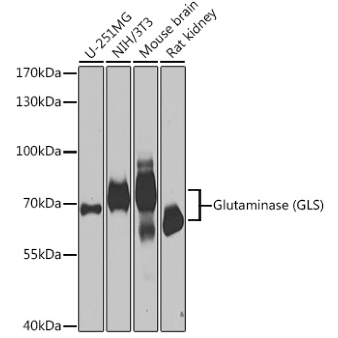 Glutaminase (GLS) Rabbit Polyclonal Antibody