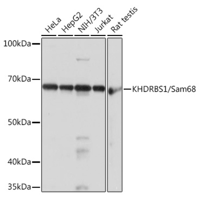 KHDRBS1/Sam68 Rabbit Monoclonal Antibody