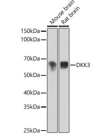 DKK3 Rabbit Monoclonal Antibody