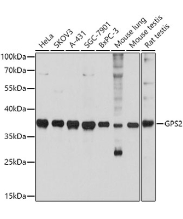 GPS2 Rabbit Polyclonal Antibody