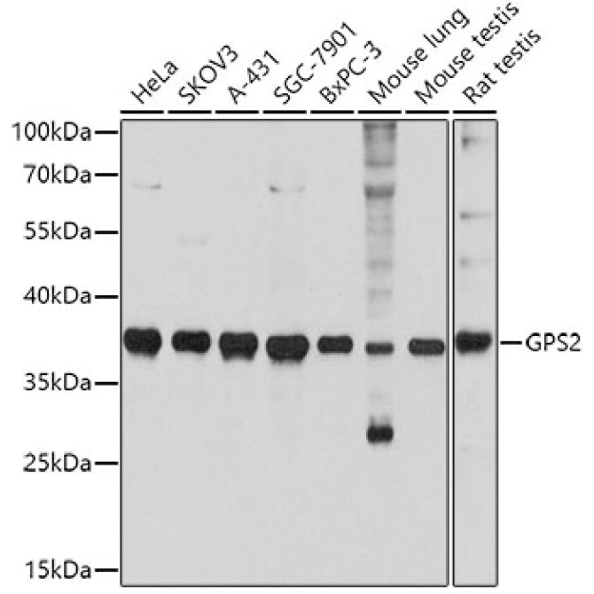 GPS2 Rabbit Polyclonal Antibody