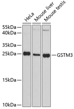GSTM3 Rabbit Polyclonal Antibody