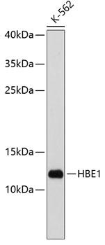 HBE1 Rabbit Polyclonal Antibody