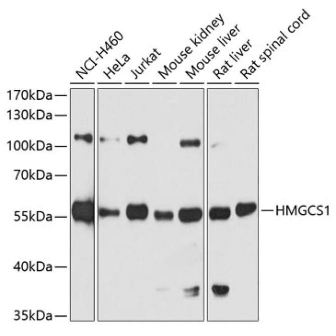 HMGCS1 Rabbit Polyclonal Antibody