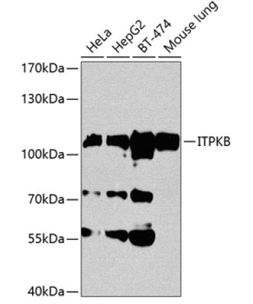ITPKB Rabbit Polyclonal Antibody