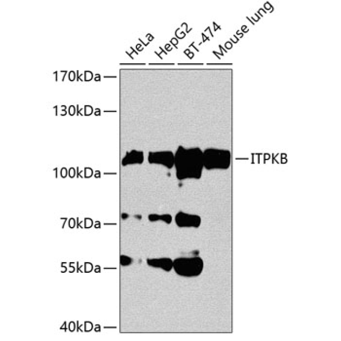 ITPKB Rabbit Polyclonal Antibody