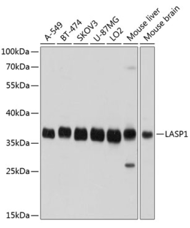 LASP1 Rabbit Polyclonal Antibody